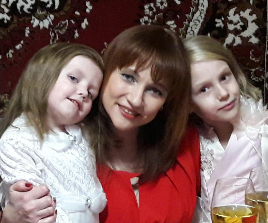 Матери двух девочек ампутировали ногу: сбор помощи в Подольске